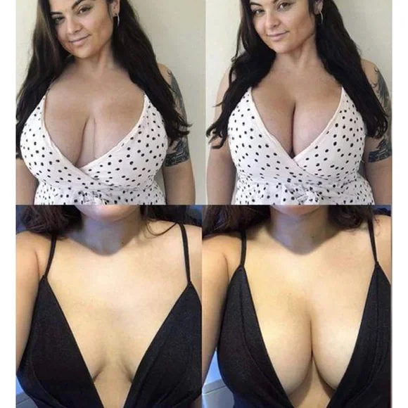 Shapewind Invisible Bra Kit - Picture 2 of 2